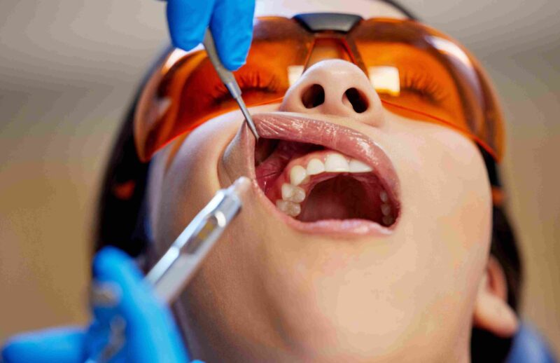 Patient receiving a dental examination while wearing protective glasses during treatment